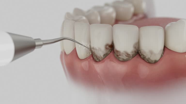 Reliable Tooth Extraction contractor in Lovington, NM by Smile Center Dentistry